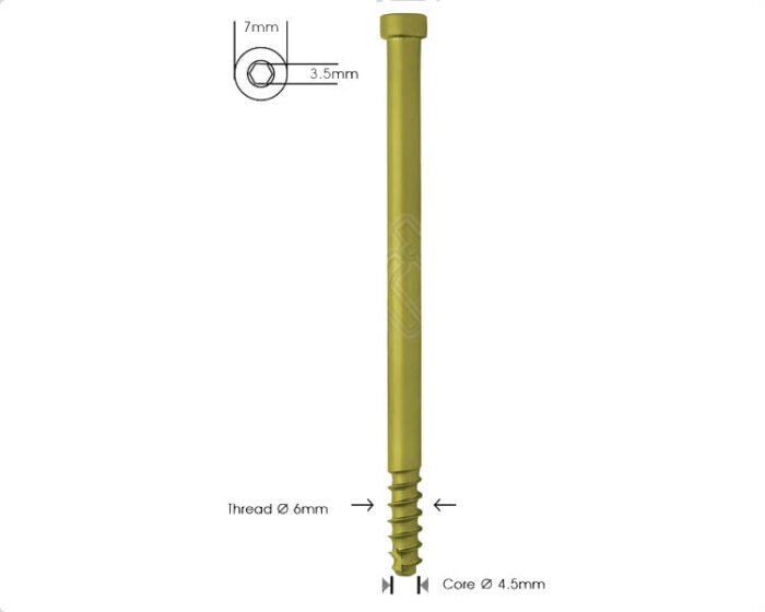 Locking Bolt Ã˜6mm Cannulated Self Tapping For Pfn & Recon Nails
