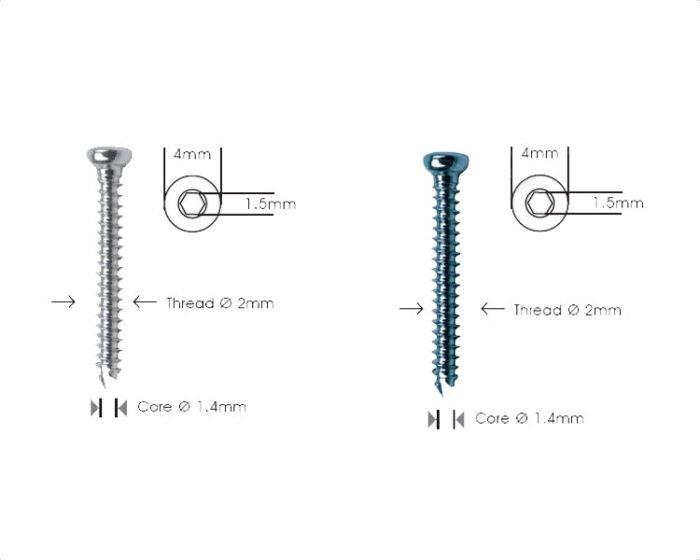 Cortex Screw Ã˜ 2.0mm Self Tapping