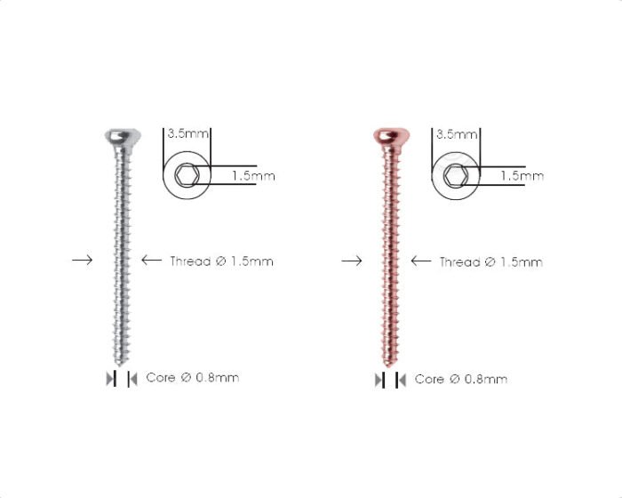 Cortex Screw Ã˜1.5mm