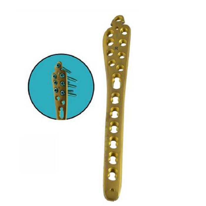 LCP Medial Distal Tibia Plate - Image 2