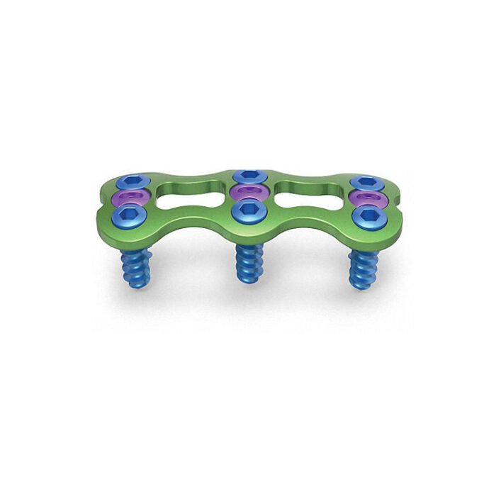 Spinal Surgical Instrument Set - Image 5